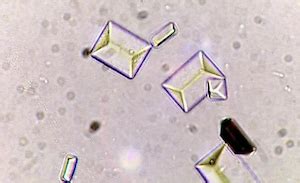 Kalsiyum fosfat kristalleri